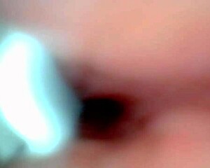 Endoscope captures sloppy cum swallow in hospital