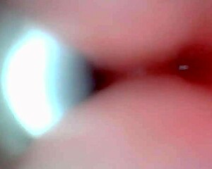 Endoscope captures sloppy cum swallow in hospital