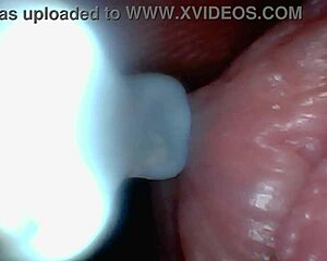 Endoscope camera reveals raw moment of male ejaculation inside