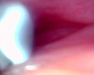 אנדוסקופ מצלם בליעת זרע מבולגנת בבית חולים