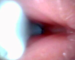 Endoscope captures sloppy cum swallow in hospital