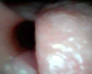 Endoscope captures sloppy cum swallow in hospital