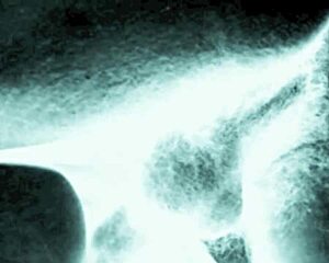 vintage erotic drawings of hairy beavers