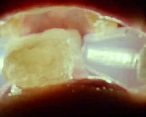 Deranged Rebel Rhyder Swallows FROZEN CUM BUKKAKE In Extreme Blowbang Probe Lens