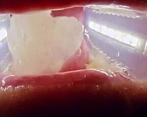 Deranged Rebel Rhyder Swallows FROZEN CUM BUKKAKE In Extreme Blowbang Probe Lens