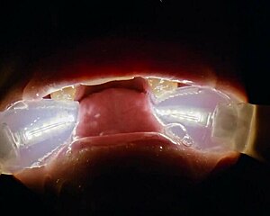 Deranged Rebel Rhyder Swallows FROZEN CUM BUKKAKE In Extreme Blowbang Probe Lens